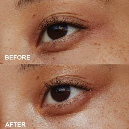 PHOFAY Anti-Wrinkle Eye Cream - Hydrating & Firming Formula